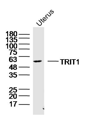 1 - TRIT1 Rabbit pAb AP56571