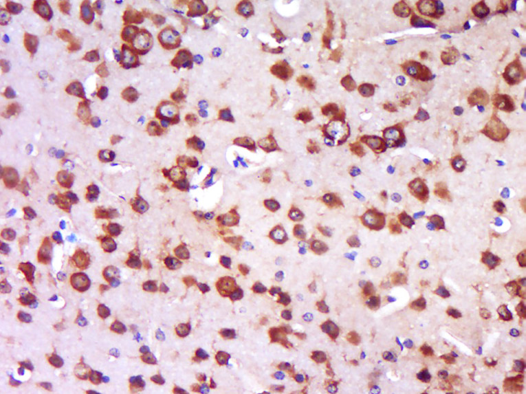 14 - TRIT1 Rabbit pAb AP56571