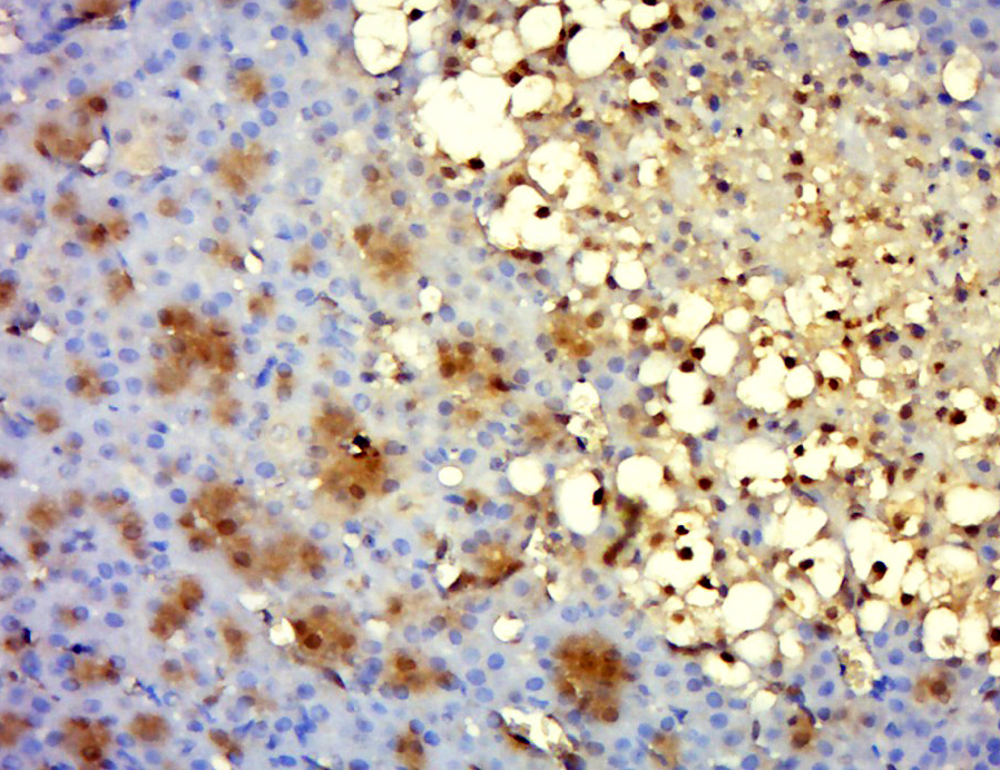14 - TRMT12 Rabbit pAb AP56576