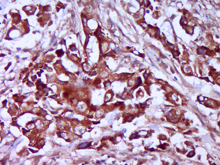 14 - TRMT61B Rabbit pAb AP56578