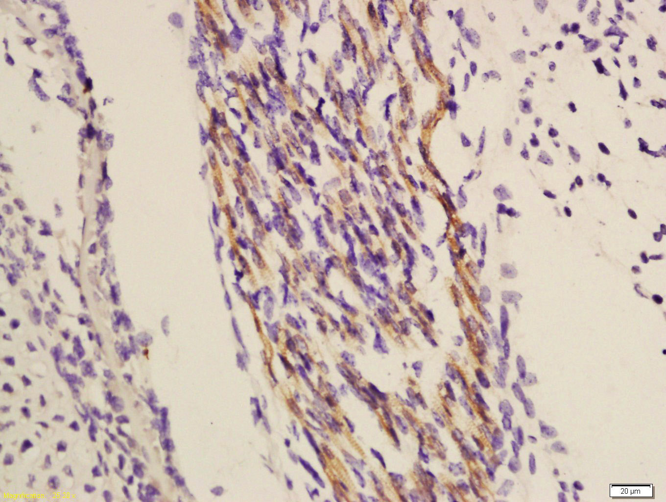 14 - TRIOBP Rabbit pAb AP56581