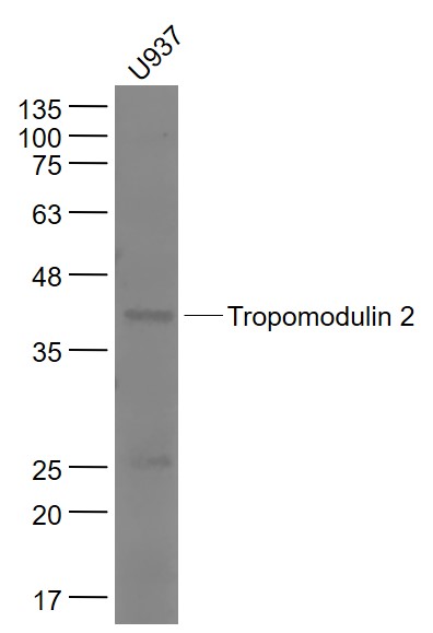 1 - Tropomodulin 2 Rabbit pAb AP56583