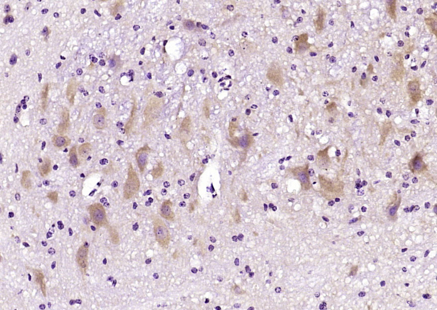 14 - Tropomodulin 2 Rabbit pAb AP56583