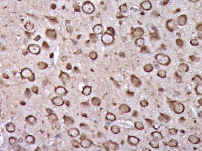 14 - Tropomodulin 3 Rabbit pAb AP56584
