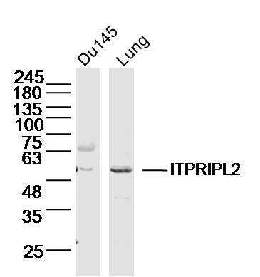 1 - ITPRIPL2 Rabbit pAb AP56596