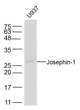 1 - Josephin-1 Rabbit pAb AP56606