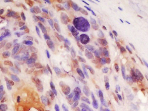 14 - TOMM22 Rabbit pAb AP56618