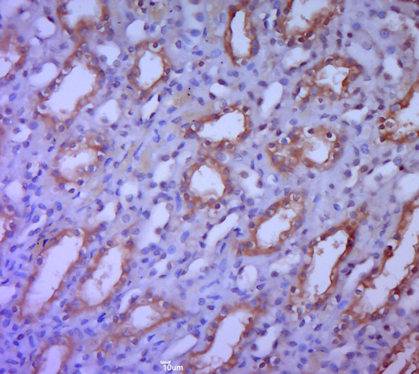 14 - SAV1 Rabbit pAb AP56622