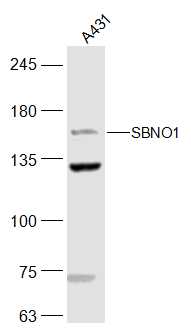1 - SBNO1 Rabbit pAb AP56627