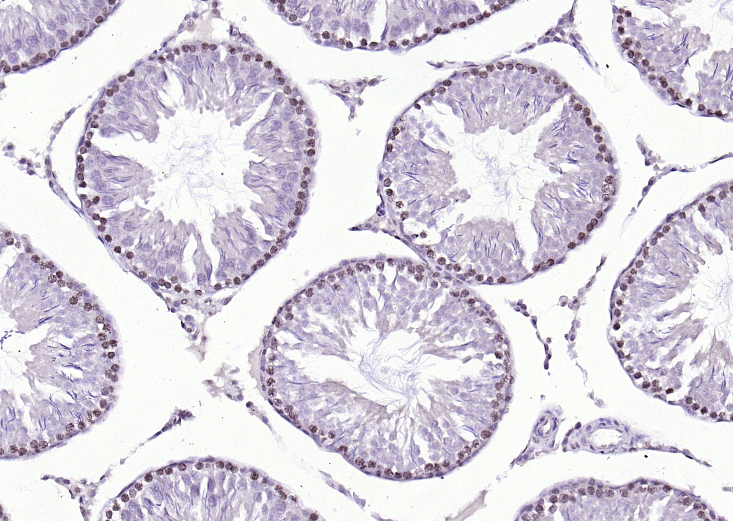 14 - SBNO1 Rabbit pAb AP56627