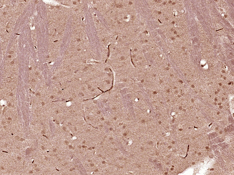 14 - SCML4 Rabbit pAb AP56647
