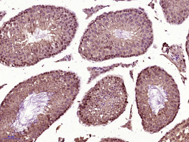 14 - SCNM1 Rabbit pAb AP56649
