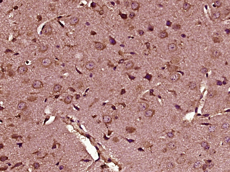 14 - HOGA1 Rabbit pAb AP56665