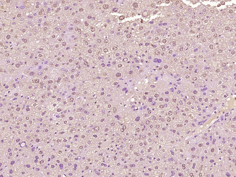 14 - HOXD1 Rabbit pAb AP56675