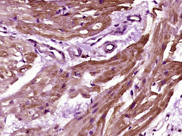 14 - HRC Rabbit pAb AP56682