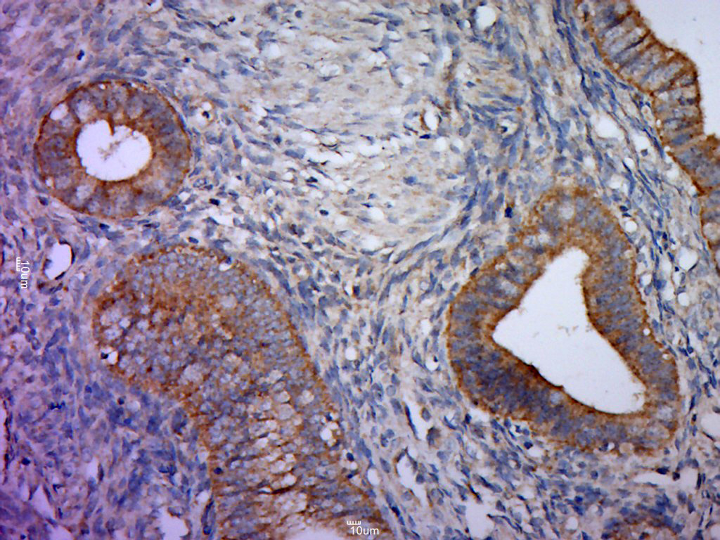 14 - Shroom 3 Rabbit pAb AP56707