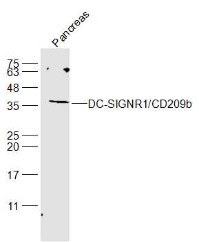 1 - DC-SIGNR1/CD209b Rabbit pAb AP56713