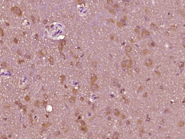 14 - SIPA1L1 Rabbit pAb AP56717