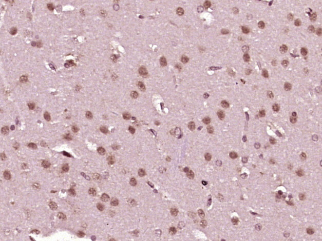 14 - SKOR1 Rabbit pAb AP56721