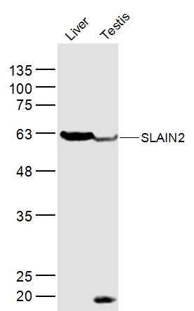 1 - SLAIN2 Rabbit pAb AP56723