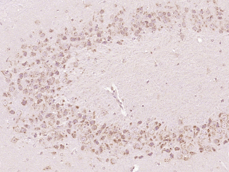 14 - OSBPL11 Rabbit pAb AP56726