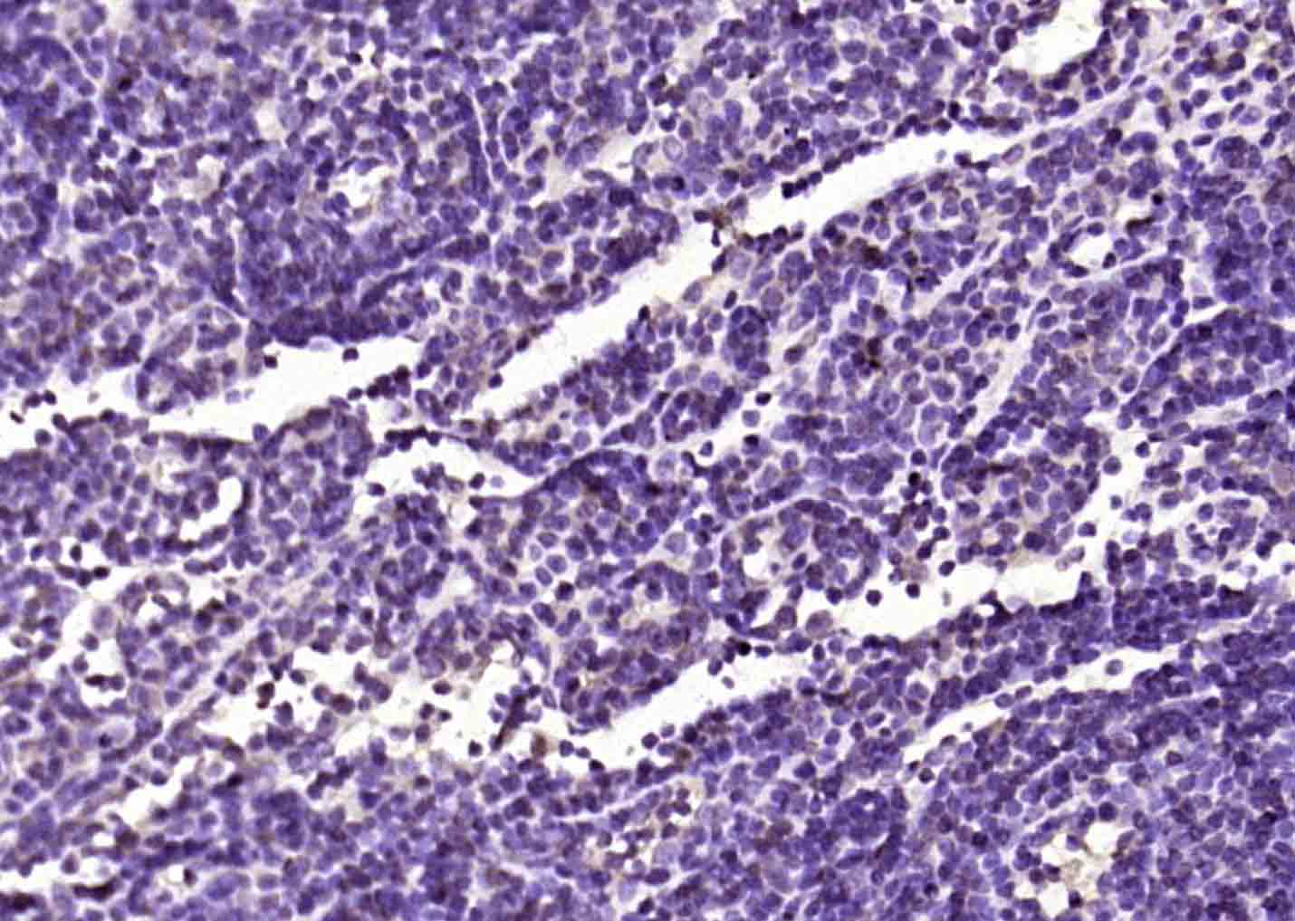 14 - OSBPL3 Rabbit pAb AP56727