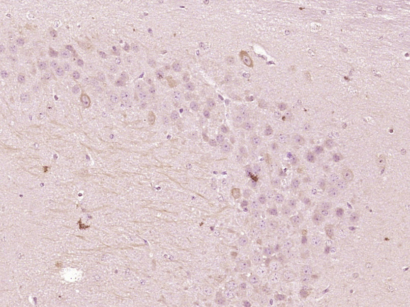 14 - OSBPL5 Rabbit pAb AP56728
