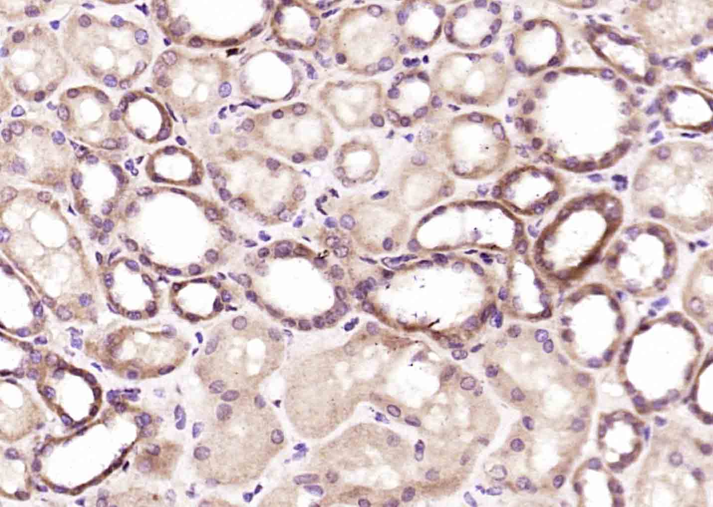 14 - OSBPL9 Rabbit pAb AP56731