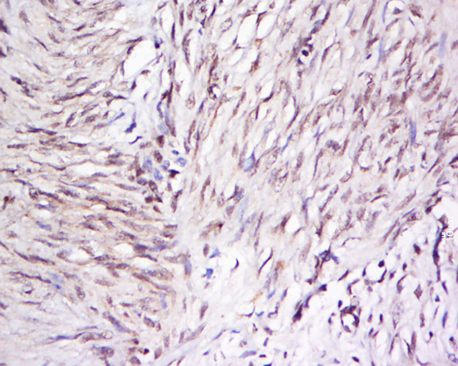 14 - OTUD5/DUBA Rabbit pAb AP56745