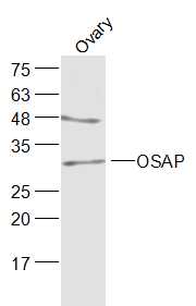 1 - OSAP/Ovary-specific acidic protein Rabbit pAb AP56746