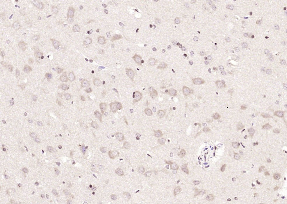 14 - METTL3 Rabbit pAb AP56756