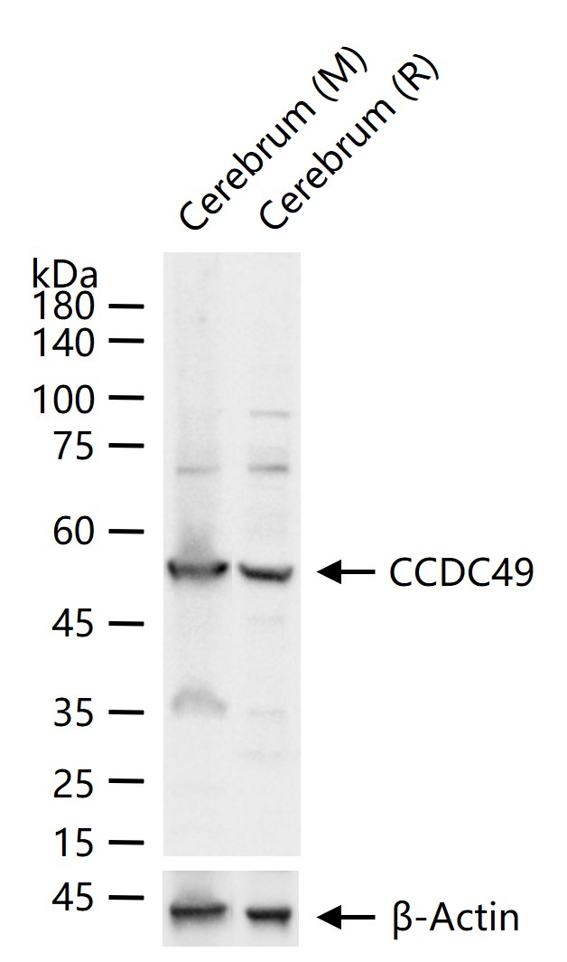1 - CCDC49 Rabbit pAb AP56757