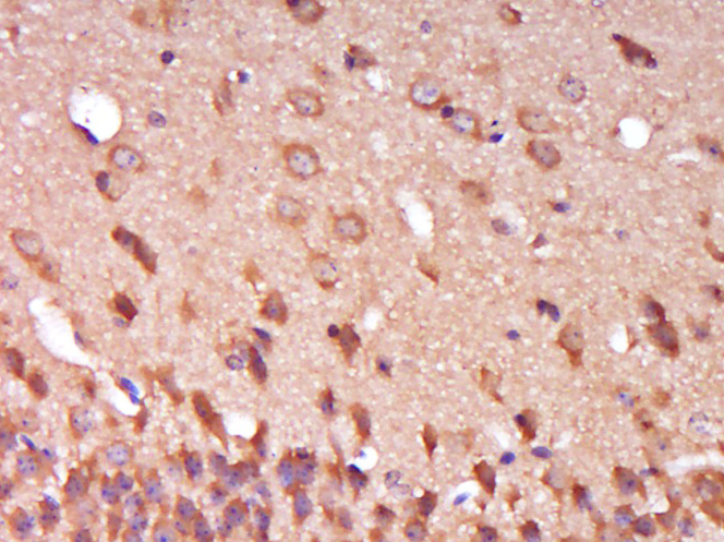 14 - SPG11 Rabbit pAb AP56778