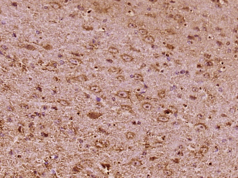 14 - SPINK6 Rabbit pAb AP56789