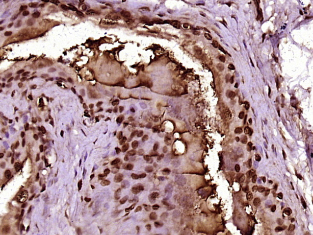14 - MPP6/MPHOSPH6 Rabbit pAb AP56795