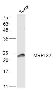 1 - MRPL22 Rabbit pAb AP56828
