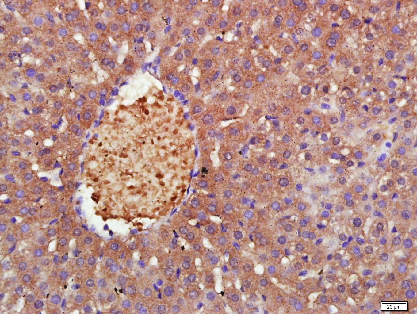 14 - MRS2 Rabbit pAb AP56855