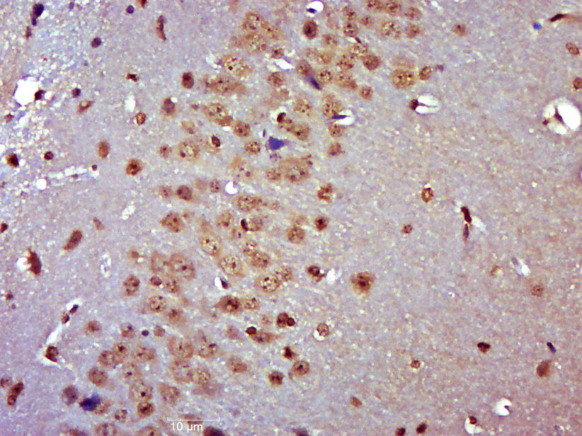 14 - MSANTD2/C11orf61 Rabbit pAb AP56864