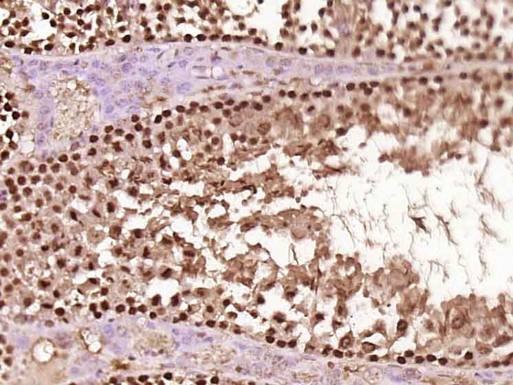 14 - MSH4 Rabbit pAb AP56866