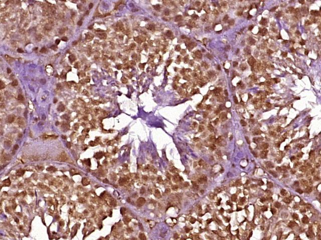 14 - MSH5 Rabbit pAb AP56867