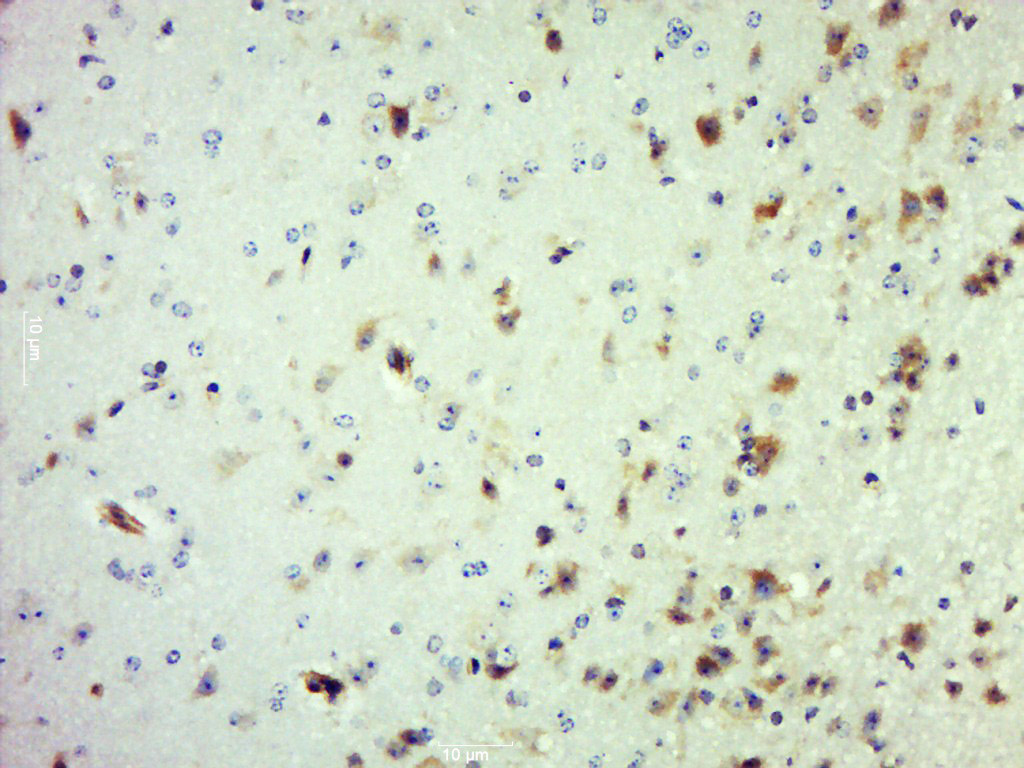 14 - MSTO1 Rabbit pAb AP56874
