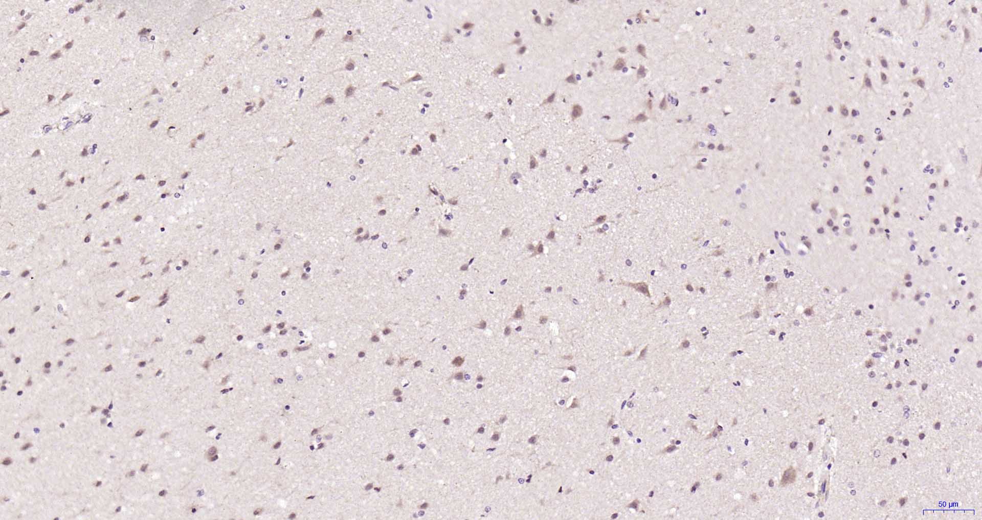 14 - MT-ATP6 Rabbit pAb AP56875