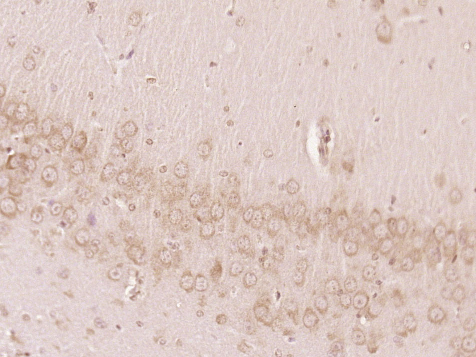 14 - MTMR7 Rabbit pAb AP56885