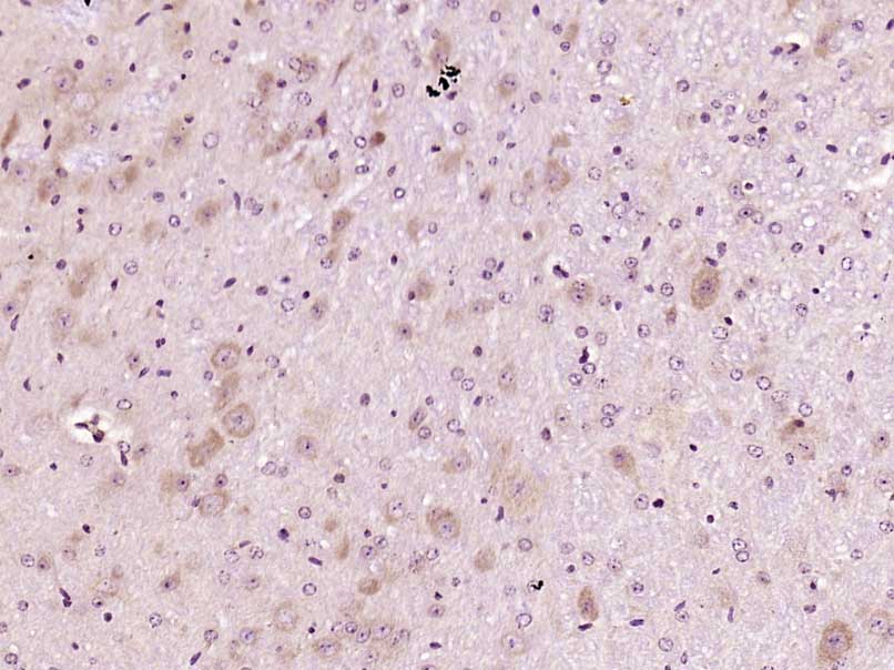14 - MTO1 Rabbit pAb AP56886