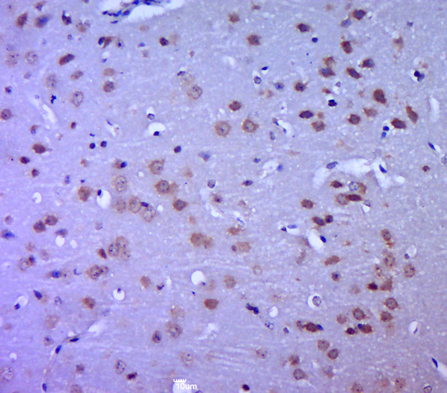 14 - MTX1 Rabbit pAb AP56889