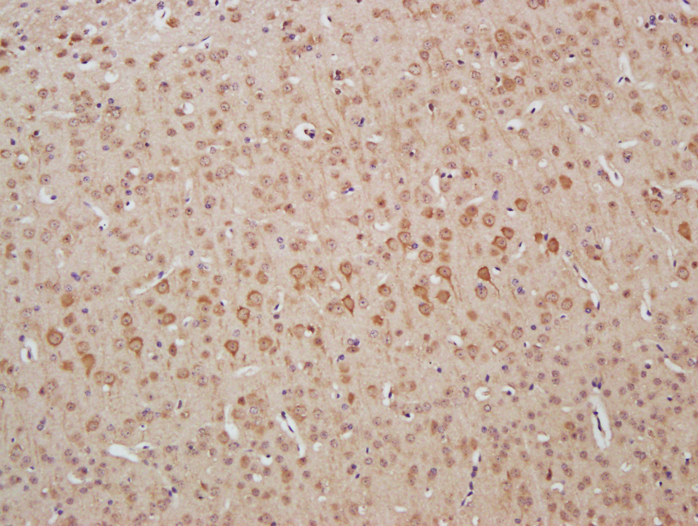 14 - HMBOX1 Rabbit pAb AP56928