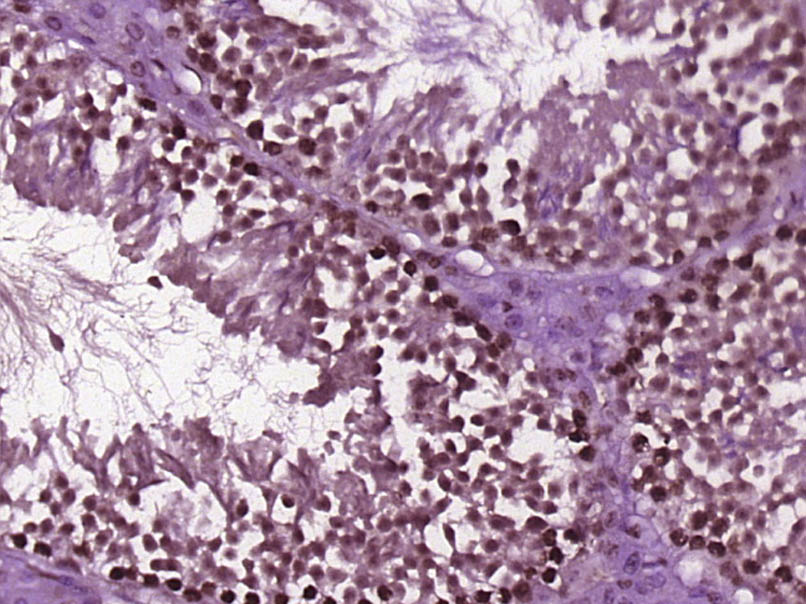 14 - HMG2L1 Rabbit pAb AP56931