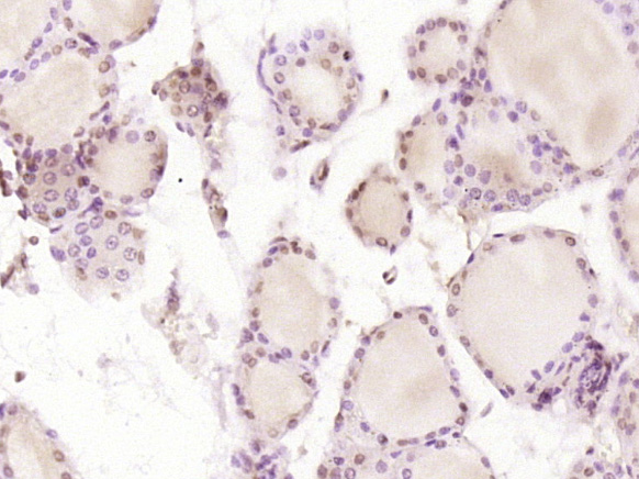 14 - HSPC111 Rabbit pAb AP56945
