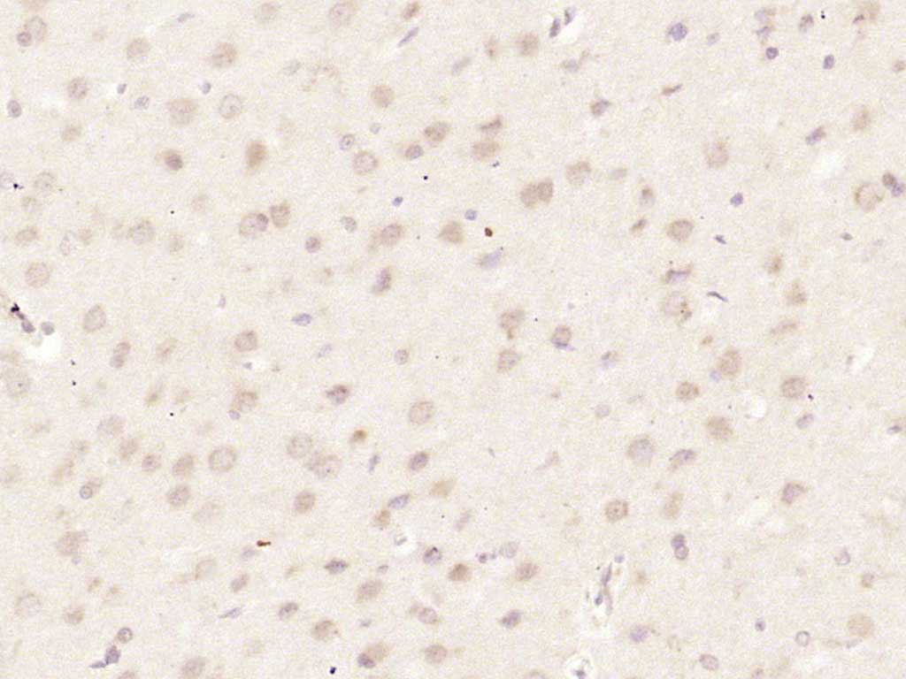 14 - HUS1 Rabbit pAb AP56952