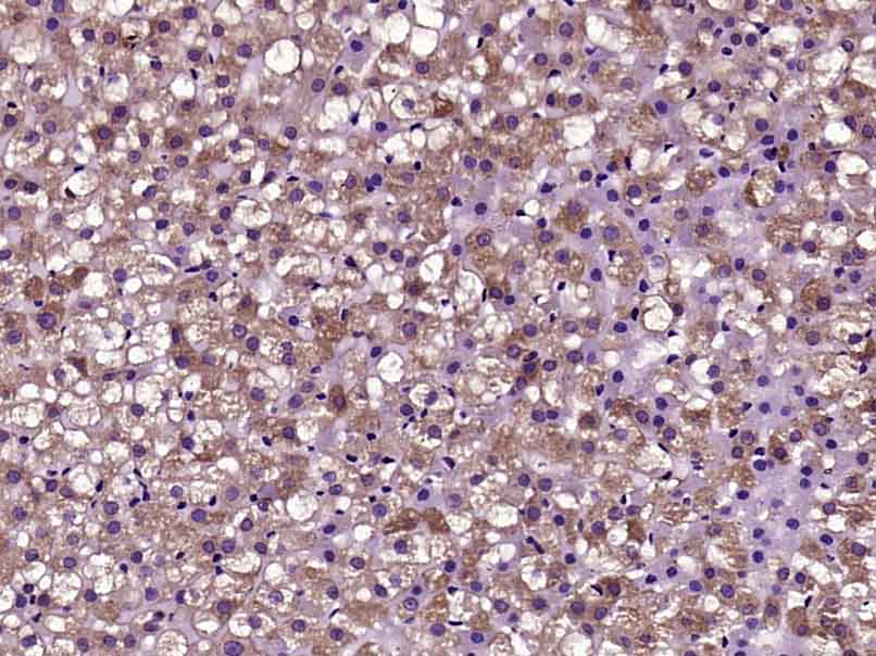 14 - HUS1B Rabbit pAb AP56953